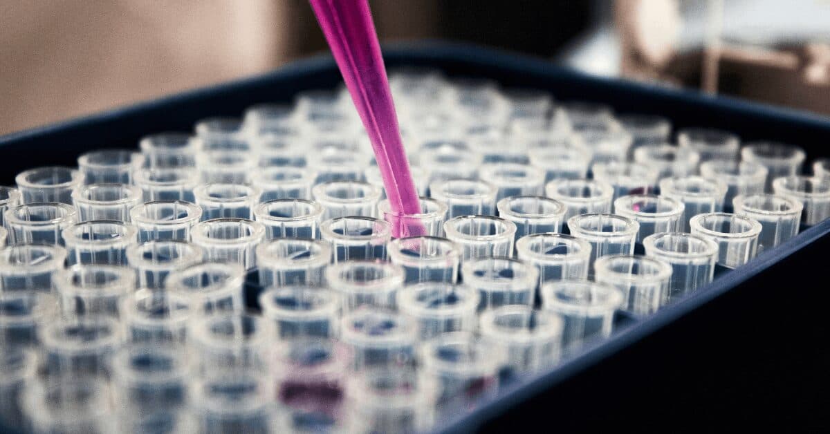 What is the Bone Profile Blood Test? All You Need To Know