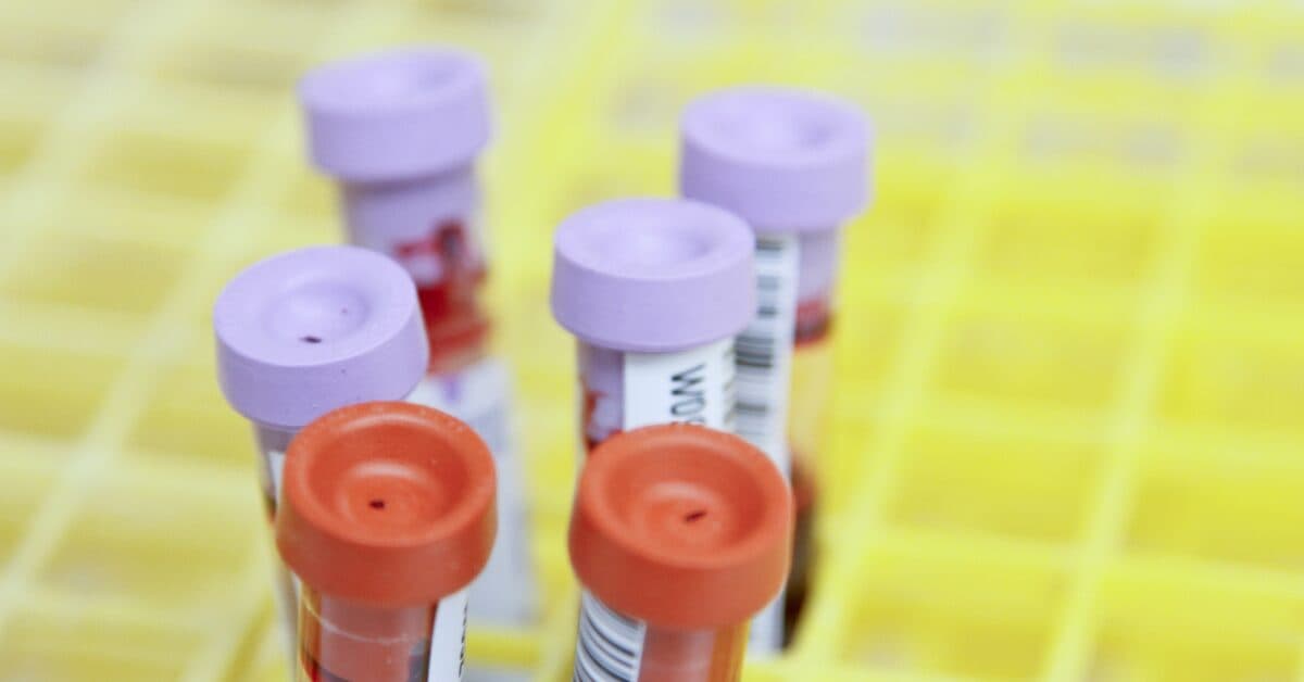 Can a Blood Test Detect Cancer?